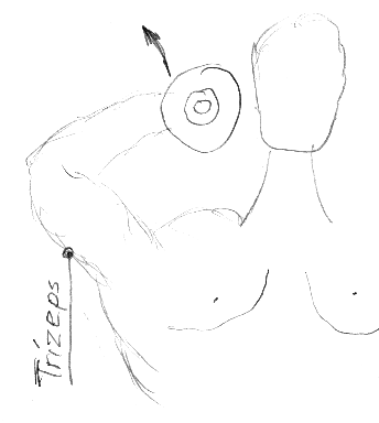 Trizeps